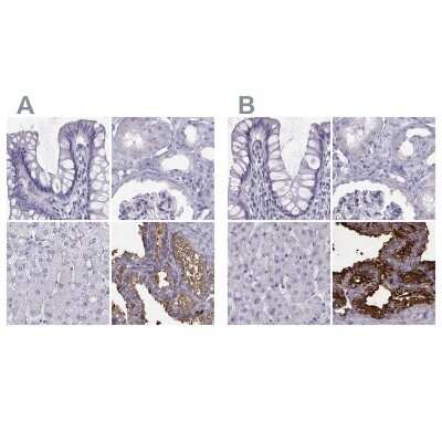 Immunohistochemistry-Paraffin: Semenogelin I Antibody [NBP2-62646]