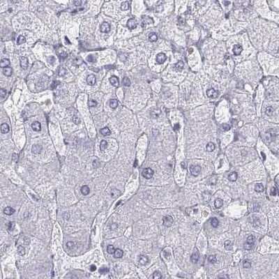 Immunohistochemistry-Paraffin: Semenogelin I Antibody [NBP2-62646]