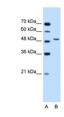 Western Blot: Semenogelin I Antibody [NBP1-58013]