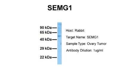 Western Blot: Semenogelin I Antibody [NBP1-58013]