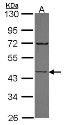 Western Blot: Semenogelin I Antibody [NBP2-20292]