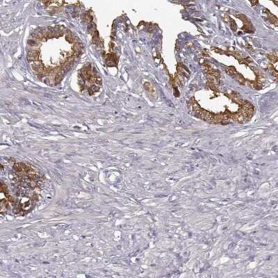 Immunohistochemistry-Paraffin: Semenogelin II Antibody [NBP1-92376]