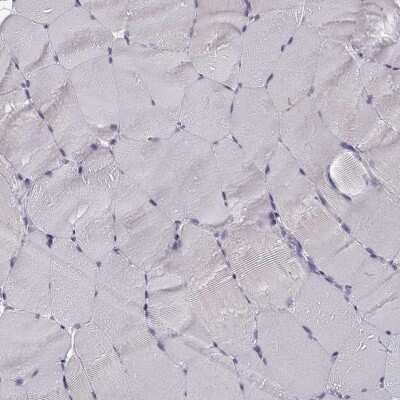 Immunohistochemistry-Paraffin: Semenogelin II Antibody [NBP1-92376]