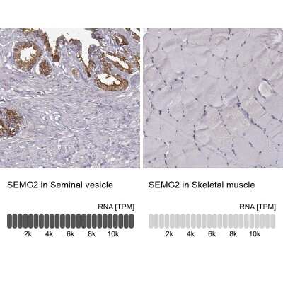 Immunohistochemistry-Paraffin: Semenogelin II Antibody [NBP1-92376]
