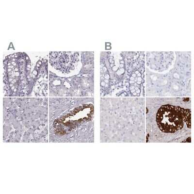 Immunohistochemistry-Paraffin: Semenogelin II Antibody [NBP1-92376]