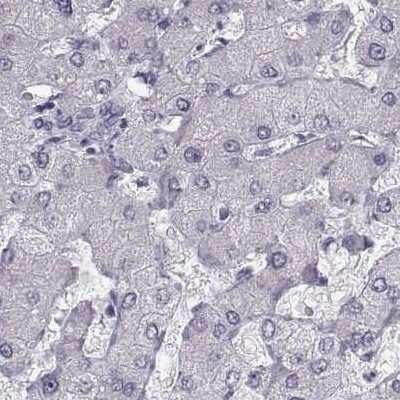 Immunohistochemistry-Paraffin: Semenogelin II Antibody [NBP1-92376]