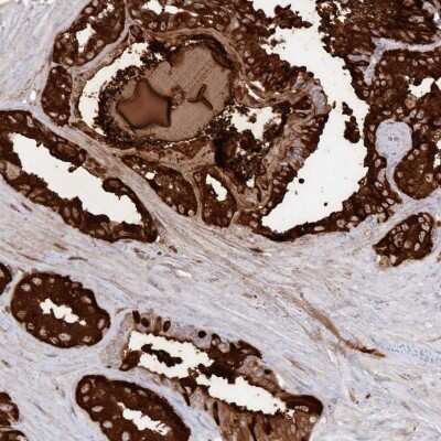 Immunohistochemistry-Paraffin: Semenogelin II Antibody [NBP1-92377]