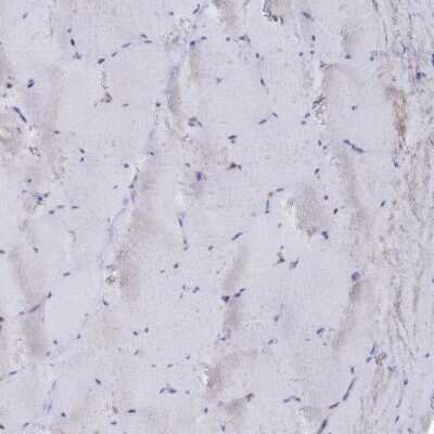 Immunohistochemistry-Paraffin: Semenogelin II Antibody [NBP1-92377]