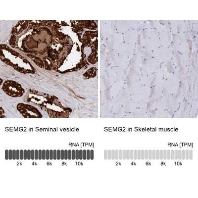 Immunohistochemistry-Paraffin: Semenogelin II Antibody [NBP1-92377]