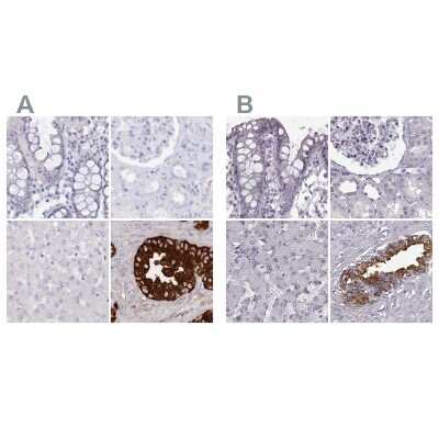 Immunohistochemistry-Paraffin: Semenogelin II Antibody [NBP1-92377]