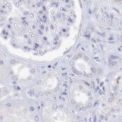 Immunohistochemistry-Paraffin: Semenogelin II Antibody [NBP1-92377]