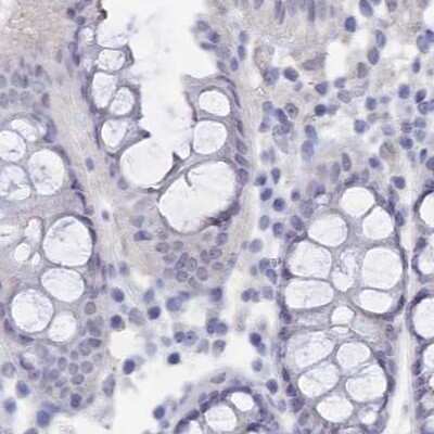Immunohistochemistry-Paraffin: Semenogelin II Antibody [NBP1-92377]