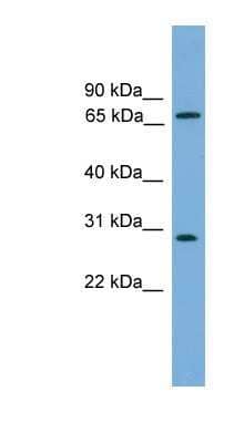 Western Blot: Semenogelin II Antibody [NBP1-80501]