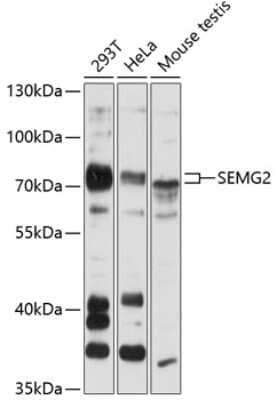 Western Blot: Semenogelin II AntibodyAzide and BSA Free [NBP2-93405]