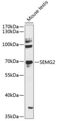 Western Blot: Semenogelin II AntibodyAzide and BSA Free [NBP2-93509]