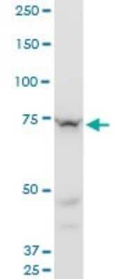 Western Blot: Senataxin Antibody (2A9) [H00023064-M05]