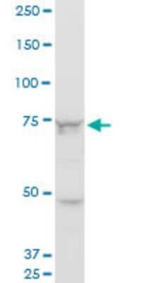 Western Blot: Senataxin Antibody (2A9) [H00023064-M05]