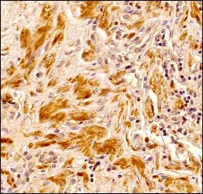 Immunohistochemistry: Senataxin Antibody (4G1) - Azide and BSA Free [NBP2-80943]