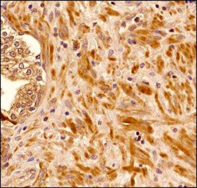 Immunohistochemistry-Paraffin: Senataxin Antibody (5D8) - BSA Free [NBP2-52727]