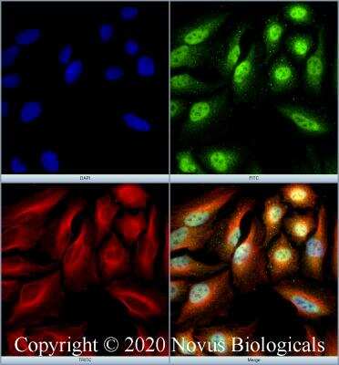 Immunocytochemistry/ Immunofluorescence: Senataxin Antibody - BSA Free [NBP1-94712]