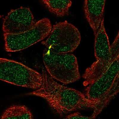 Immunocytochemistry/ Immunofluorescence: Senataxin Antibody [NBP2-13300]