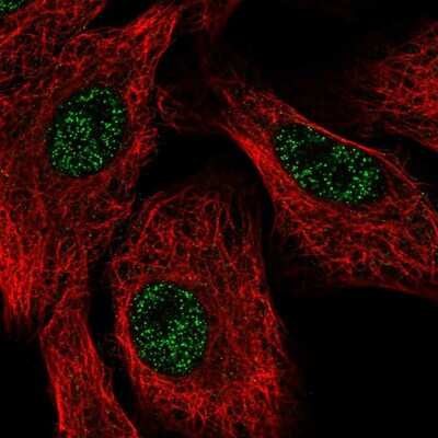 Immunocytochemistry/ Immunofluorescence: Senataxin Antibody [NBP2-58495]