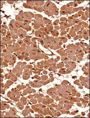 Immunohistochemistry-Paraffin: Senataxin Antibody - BSA Free [NBP1-94712]