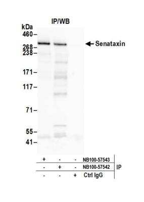 Immunoprecipitation: Senataxin Antibody [NB100-57542]