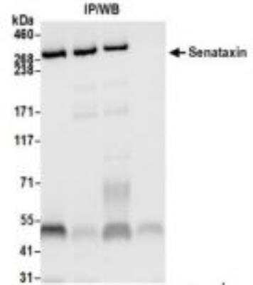 Immunoprecipitation: Senataxin Antibody (BLR050F) [NBP3-14676]