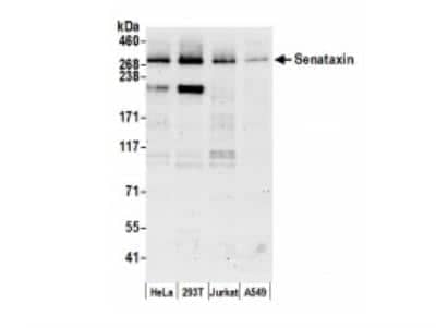 Western Blot: Senataxin Antibody [NB100-57542]