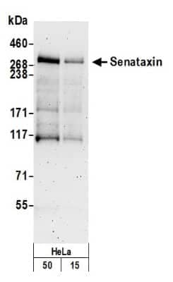 Western Blot: Senataxin Antibody [NB100-57543]