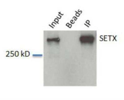 Western Blot: Senataxin AntibodyBSA Free [NBP1-94712]