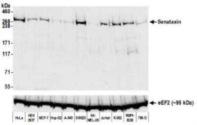 Western Blot: Senataxin Antibody (BLR050F) [NBP3-14676]