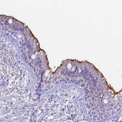Immunohistochemistry-Paraffin: Sentan Antibody [NBP1-92378]