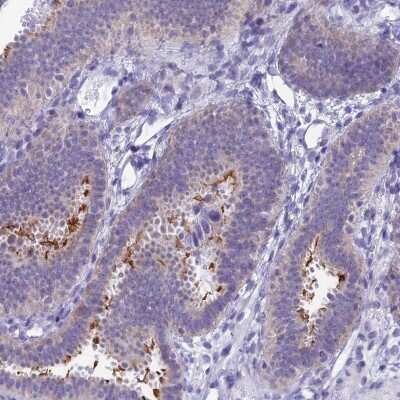 Immunohistochemistry-Paraffin: Sentan Antibody [NBP1-92378]