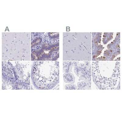 Immunohistochemistry-Paraffin: Sentan Antibody [NBP1-92378]