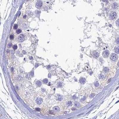 Immunohistochemistry-Paraffin: Sentan Antibody [NBP1-92378]