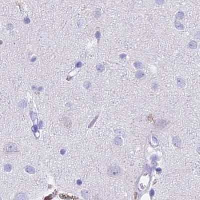 Immunohistochemistry-Paraffin: Sentan Antibody [NBP1-92378]