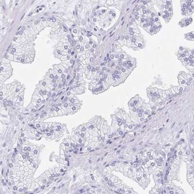 Immunohistochemistry-Paraffin: Sentan Antibody [NBP2-38853]