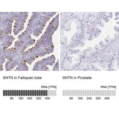 Immunohistochemistry-Paraffin: Sentan Antibody [NBP2-38853]