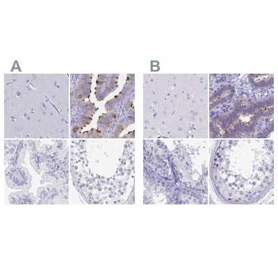 Immunohistochemistry-Paraffin: Sentan Antibody [NBP2-38853]