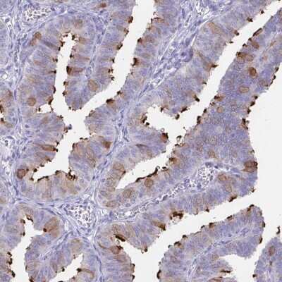 Immunohistochemistry-Paraffin: Sentan Antibody [NBP2-38853]