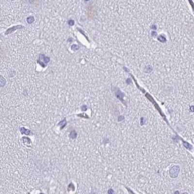 Immunohistochemistry-Paraffin: Sentan Antibody [NBP2-38853]