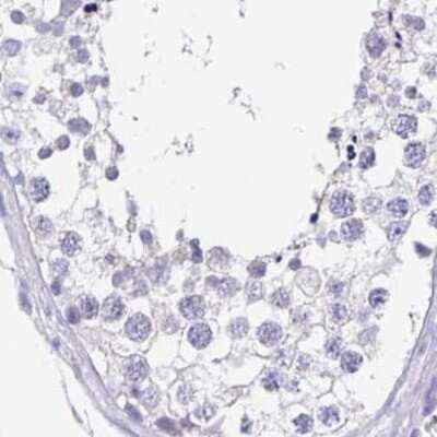 Immunohistochemistry-Paraffin: Sentan Antibody [NBP2-38853]