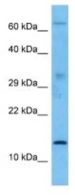 Western Blot: Sentan Antibody [NBP3-10202]