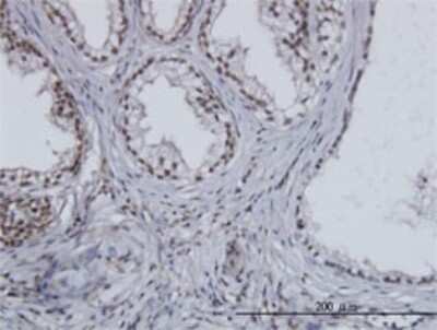 Immunohistochemistry-Paraffin: Separase Antibody (6H6) [H00009700-M01]