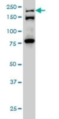 Western Blot: Separase Antibody (6H6) [H00009700-M01]