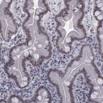 Immunohistochemistry-Paraffin: Separase Antibody [NBP3-17190]