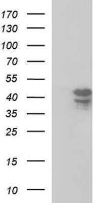 Western Blot: Septin-1 Antibody (OTI1E1) [NBP2-45762]