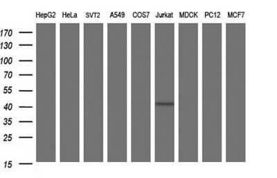 Western Blot: Septin-1 Antibody (OTI1E1) [NBP2-45762]